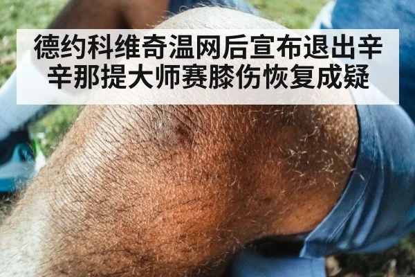 德约科维奇温网后宣布退出辛辛那提大师赛膝伤恢复成疑